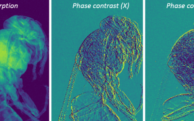 XPulse project : extracting more information from X-Ray imaging