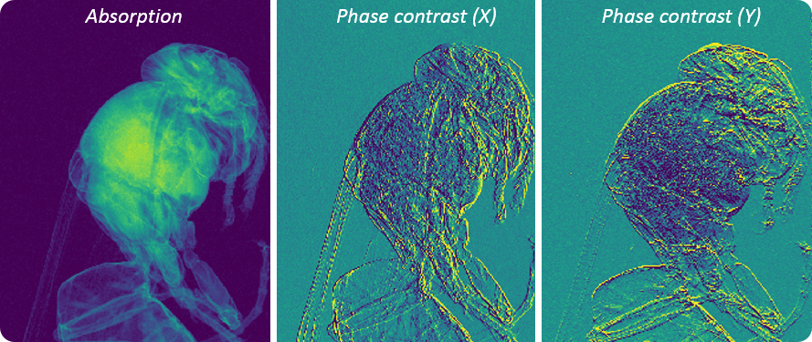 XPulse project : extracting more information from X-Ray imaging