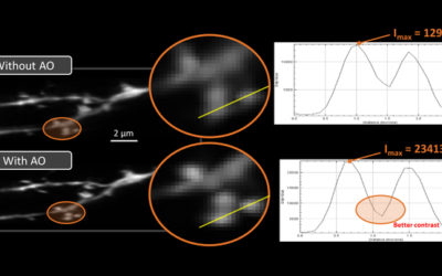 Adaptive Optics boost Lattice Light Sheet Microscope in Premiere