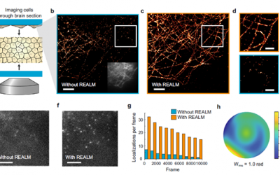 REALM, aberration correction for PALM/STORM microscopy – webinar