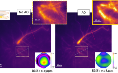 Adaptive optics microscopy direct wavefront sensing approach is more resilient to scattering.