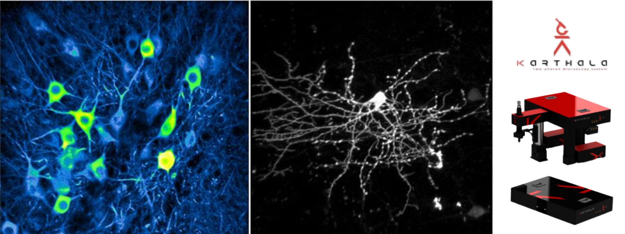 Karthala System AODscope Bioimaging